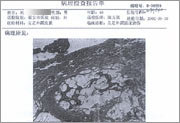 点击放大